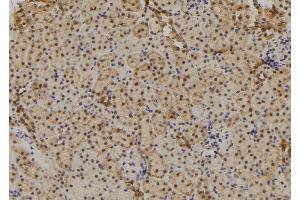 ABIN6263110 and ABIN6277711 at 1/100 staining Mouse kidney tissue by IHC-P.