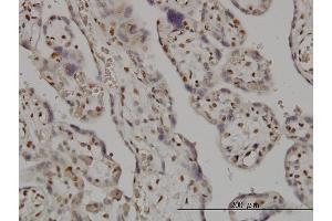 Immunoperoxidase of monoclonal antibody to SMC6L1 on formalin-fixed paraffin-embedded human placenta.