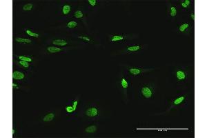 Immunofluorescence of purified MaxPab antibody to MYNN on HeLa cell.