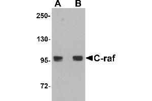 Western blot analysis of C-raf in 3T3 cell lysate with C-raf antibody at (A) 0. (RAF1 Antikörper  (N-Term))