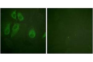 Immunofluorescence analysis of HeLa cells, using IL-2R alpha/CD25 (Ab-268) Antibody. (CD25 Antikörper  (AA 223-272))
