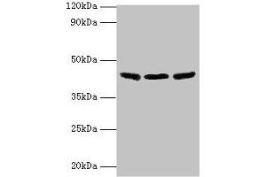 Western blot All lanes: IDH3B antibody at 2 μg/mL Lane 1: Hela whole cell lysate Lane 2: Mouse kidney tissue Lane 3: Mouse gonadal tissue Secondary Goat polyclonal to rabbit IgG at 1/10000 dilution Predicted band size: 43, 42, 26 kDa Observed band size: 43 kDa