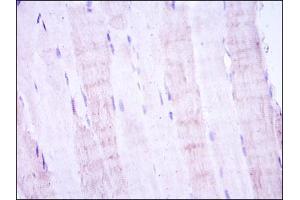 Immunohistochemistry (IHC) image for anti-Mitogen-Activated Protein Kinase Kinase 4 (MAP2K4) antibody (ABIN969268)