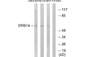 Western blot analysis of extracts from COLO cells, HUVEC cells and MCF-7 cells, using GRB14 antibody.