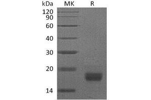 Western Blotting (WB) image for Interferon gamma (IFNG) protein (ABIN7320568) (Interferon gamma Protein (IFNG))