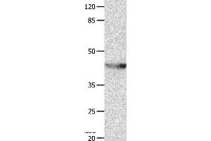 Western blot analysis of Mouse spleen tissue, using KCNA5 Polyclonal Antibody at dilution of 1:700
