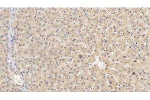 Detection of HRG in Human Liver Tissue using Monoclonal Antibody to Histidine Rich Glycoprotein (HRG)