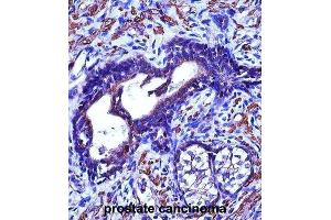 Immunohistochemistry (IHC) image for anti-Actin, gamma 2, Smooth Muscle, Enteric (ACTG2) antibody (ABIN2997383) (ACTG2 Antikörper)