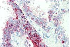 Immunohistochemistry (IHC) image for anti-Keratin 7 (KRT7) (N-Term) antibody (ABIN6754952)