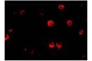 Immunofluorescence of AES in 293 cells with AES Antibody at 20 μg/ml. (AES Antikörper  (N-Term))