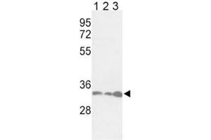 Western blot analysis of anti-PCNA antibody and Jurkat (lane 1), HeLa (2), 293 (3) lysate (PCNA Antikörper  (AA 89-117))