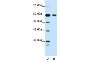 Western Blotting (WB) image for anti-Tripartite Motif Containing 32 (TRIM32) antibody (ABIN2461827) (TRIM32 Antikörper)