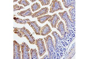 IHC analysis of CEACAM5 using anti-CEACAM5 antibody (ABIN7601435).
