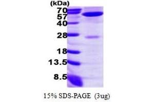 SDS-PAGE (SDS) image for Alanine Aminotransferase (ALT) (AA 1-496) protein (His tag) (ABIN667978)