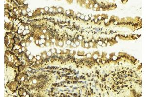 ABIN6269043 at 1/100 staining Mouse colon tissue by IHC-P. (CHEK1 Antikörper  (Internal Region))