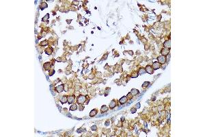 Immunohistochemistry of paraffin-embedded rat testis using T Rabbit mAb (ABIN7270916) at dilution of 1:100 (40x lens). (TACC3 Antikörper)