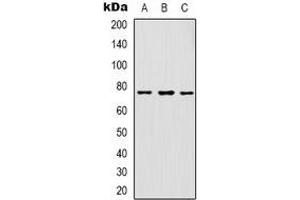Western blot analysis of GAB1 expression in K562 (A), HepG2 (B), NIH3T3 (C) whole cell lysates. (GAB1 Antikörper  (C-Term))
