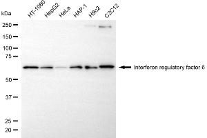 Western blotting analysis using interferon regulatory factor 6 antibody (ABIN7799087). (Rekombinanter IRF6 Antikörper)