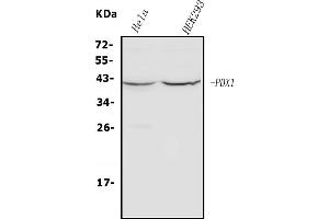 Western blot analysis of PDX1 using anti-PDX1 antibody (ABIN7601614).