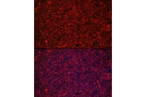 Immunofluorescence analysis of rat brain using Neurofilament L Rabbit mAb (ABIN7268867) at dilution of 1:100 (40x lens). (NEFL Antikörper)