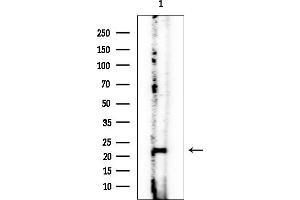 anti-Serum Amyloid A3 Pseudogene (SAA3P) antibody