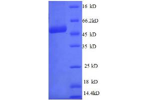 Chromosome 21 Open Reading Frame 33 (C21orf33) (AA 43-268), (full length) protein (GST tag) (C21orf33 Protein (AA 43-268, full length) (GST tag))