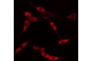 ABIN6275231 staining HuvEc cells by IF/ICC. (MAP9 Antikörper  (N-Term))