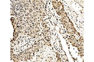IHC analysis of SPHK1 using anti-SPHK1 antibody (ABIN7600168). (SPHK1 Antikörper  (AA 16-267))