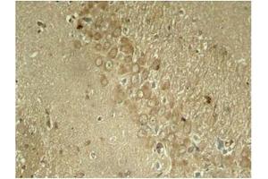 Image no. 1 for anti-Microtubule-Associated Protein tau (MAPT) (pSer262) antibody (ABIN196808) (MAPT Antikörper  (pSer262))