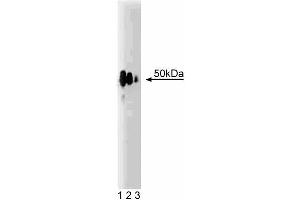 Western Blotting (WB) image for anti-Transforming Growth Factor beta 1 Induced Transcript 1 (TGFB1I1) (AA 73-186) antibody (ABIN968401)