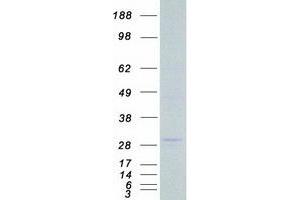Validation with Western Blot (LRP5L Protein (Transcript Variant 1) (Myc-DYKDDDDK Tag))