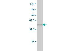 Western Blotting (WB) image for anti-Fragile X Mental Retardation 1 (FMR1) (AA 121-220) antibody (ABIN560937)