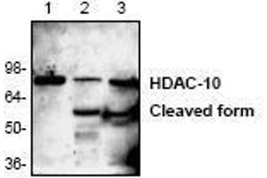 Image no. 1 for anti-Histone Deacetylase 10 (HDAC10) (N-Term) antibody (ABIN127250) (HDAC10 Antikörper  (N-Term))