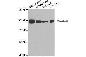 Western blot analysis of extracts of various cell lines, using MAGED1 antibody. (MAGED1 Antikörper)