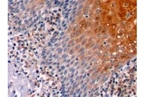 Detection of Bcl2 in Human Tonsil Tissue using Polyclonal Antibody to B-Cell Leukemia/Lymphoma 2 (Bcl2) (Bcl-2 Antikörper  (AA 2-211))