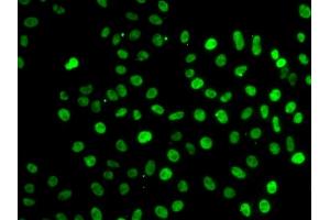 Immunofluorescence analysis of MCF-7 cells using SF3B2 antibody. (SF3B2 Antikörper)