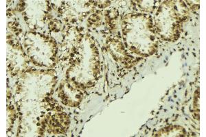 ABIN6273060 at 1/100 staining Human lung tissue by IHC-P. (NOB1 Antikörper  (C-Term))