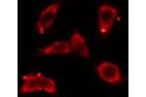 ABIN6276440 staining COLO205 cells by IF/ICC. (ARF6 Antikörper  (Internal Region))