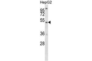 ALG11 Antibody (C-term) western blot analysis in HepG2 cell line lysates (35 µg/lane). (ALG11 Antikörper  (C-Term))