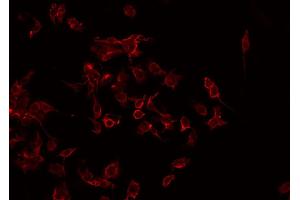 ABIN6268838 staining Hela by IF/ICC. (CMKLR1 Antikörper  (Internal Region))