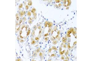 Immunohistochemistry of paraffin-embedded human stomach using TDGF1 antibody. (TDGF1 Antikörper)