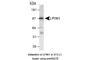 Image no. 1 for anti-Lipin 1 (LPIN1) (AA 500-600), (Internal Region) antibody (ABIN363587) (Lipin 1 Antikörper  (Internal Region))