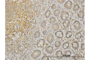 Immunostaining (ISt) image for anti-LIM Domain Kinase 1 (LIMK1) (AA 548-647) antibody (ABIN517519)