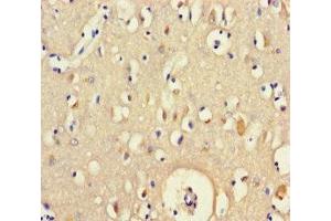 Immunohistochemistry of paraffin-embedded human brain tissue using ABIN7165132 at dilution of 1:100 (BEX5 Antikörper  (AA 1-111))