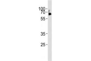 Western Blotting (WB) image for anti-Lymphocyte-Specific Protein tyrosine Kinase (LCK) (AA 480-509) antibody (ABIN3031646)