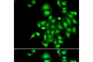 Immunofluorescence analysis of A549 cells using IL20 Polyclonal Antibody (IL-20 Antikörper)