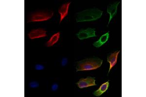 ABIN6259322 and ABIN6274776 staining Hela cells by IF/ICC. (RPL28 Antikörper  (C-Term))