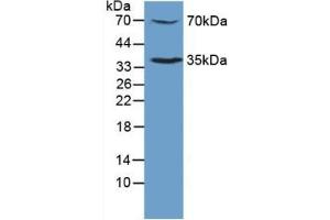Detection of TPOR in Mouse Sp2/0 Cells using Polyclonal Antibody to Thrombopoietin Receptor (TPOR) (MPL Antikörper  (AA 311-460))