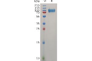Human   Protein, His Tag on SDS-PAGE under reducing condition.
