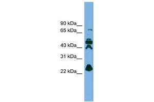 WB Suggested Anti-RPE Antibody Titration: 0. (RPE Antikörper  (N-Term))